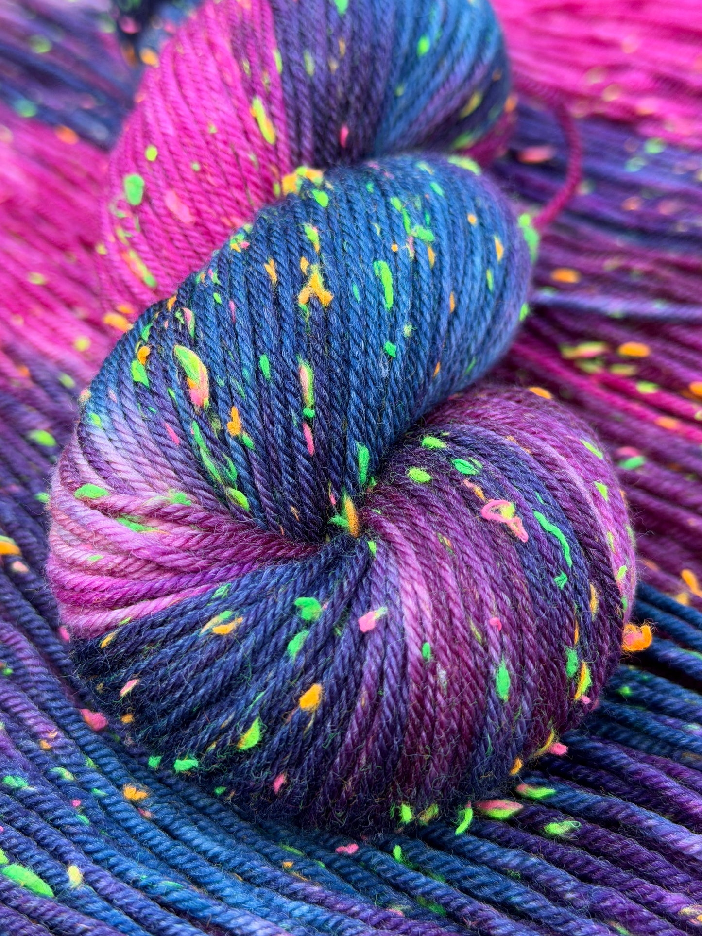 Overstimulated (One of a Kind)